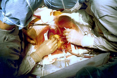 Cardiovascular