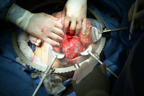 General Surgery