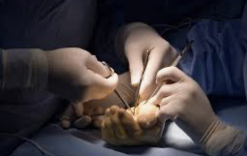 Hand Surgery