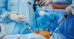 Laparoscopy